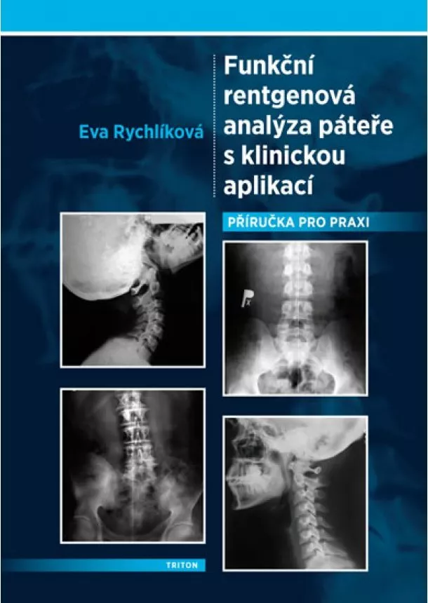 Eva Rychlíková - Funkční rentgenová analýza páteře s klinickou aplikací