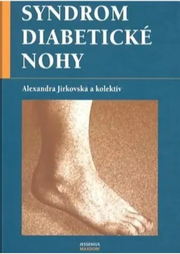 Alexandra Jirkovská - Syndrom diabetické nohy, 2.vydání