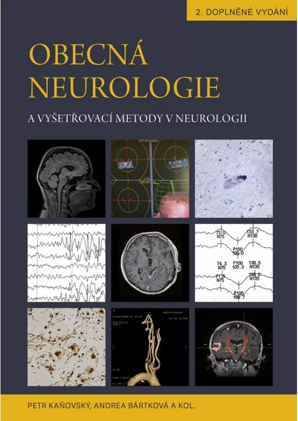 Petr Kaňovský , Andrea Bártková a kol. - Obecná neurologie a vyšetřovací metody v neurologii - 2.doplněné vydání