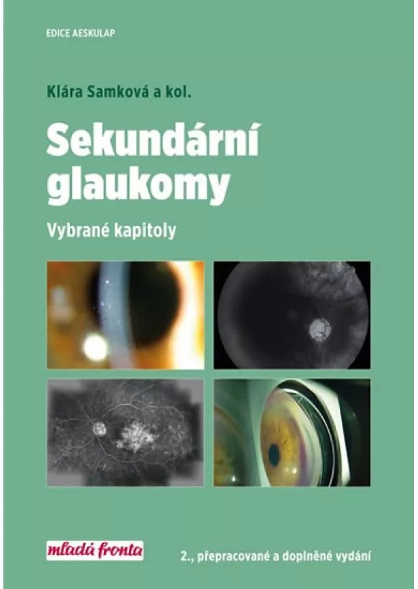 Klára Samková - Sekundární glaukomy