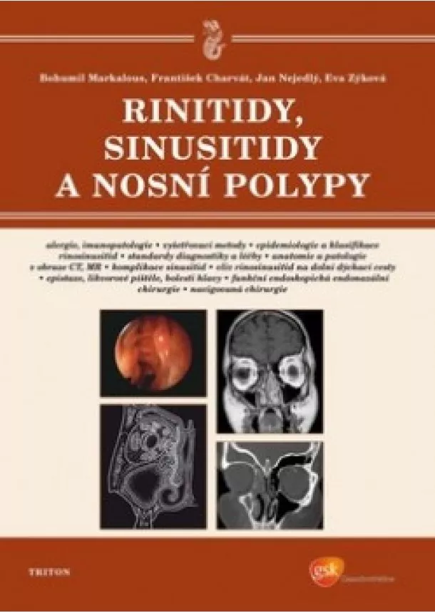 Bohumil Markalous, František Charvát, Jan Nejedlý, Eva Zýková  - Rinitidy, sinusitidy a nosní polypy