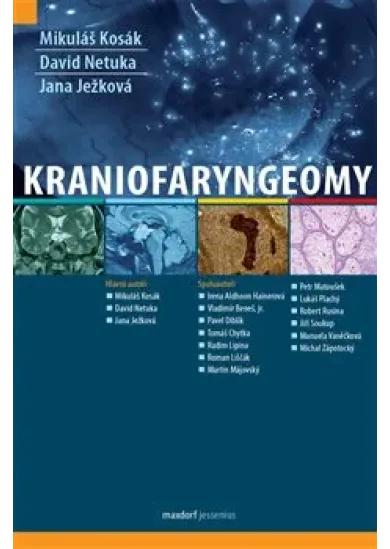 Kraniofaryngeomy