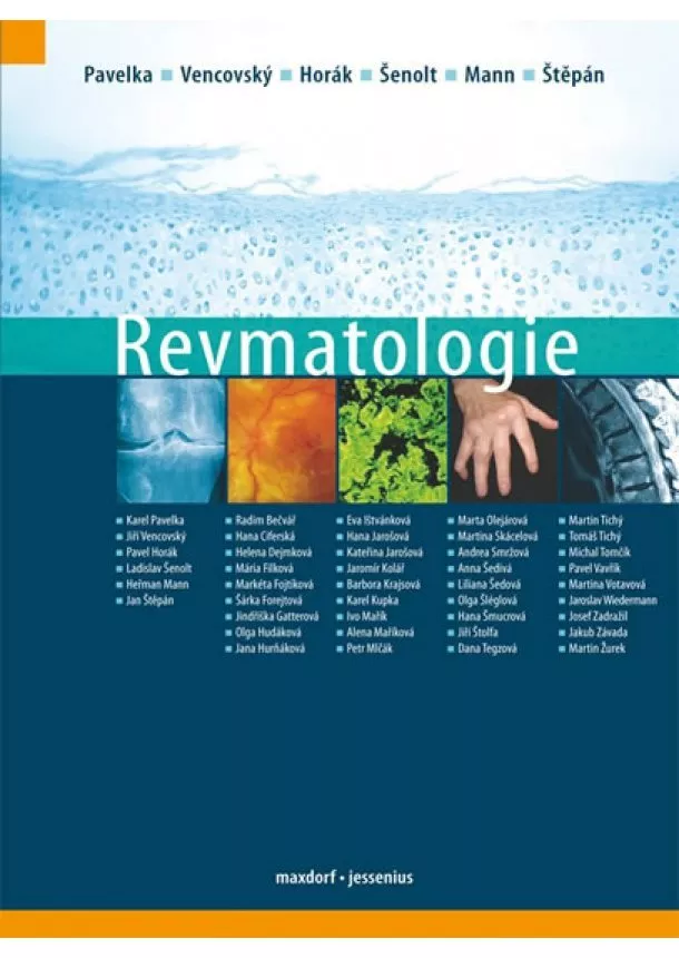 Karel Pavelka, Jiří Vencovský, Pavel Horák, Ladislav Šenolt, Heřman Mann, Jan Štěpán a kolektiv - Revmatologie