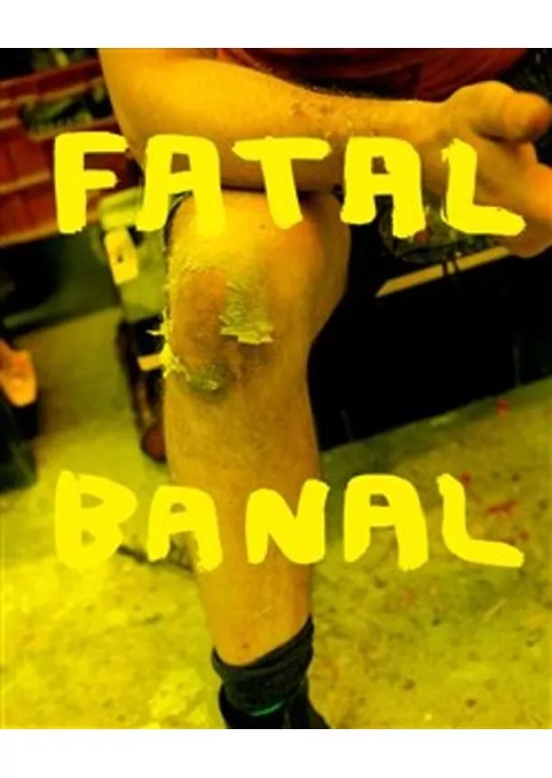 Krištof Kintera - Fatal Banal