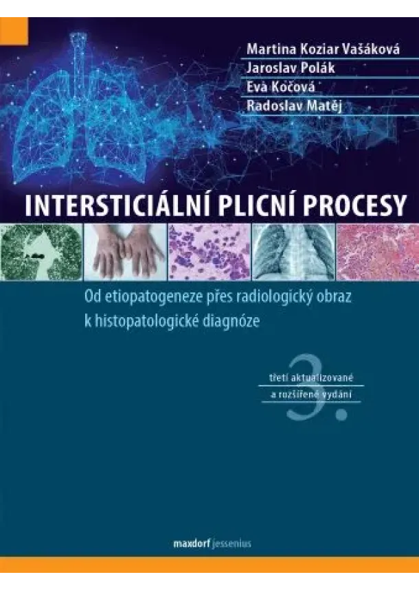 Martina Koziar Vašáková, Jaroslav Polák, Eva Kočová, Radoslav Matěj - Intersticiální plicní procesy (3. aktualizované a rozšířené vydání )