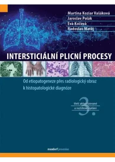 Intersticiální plicní procesy (3. aktualizované a rozšířené vydání )