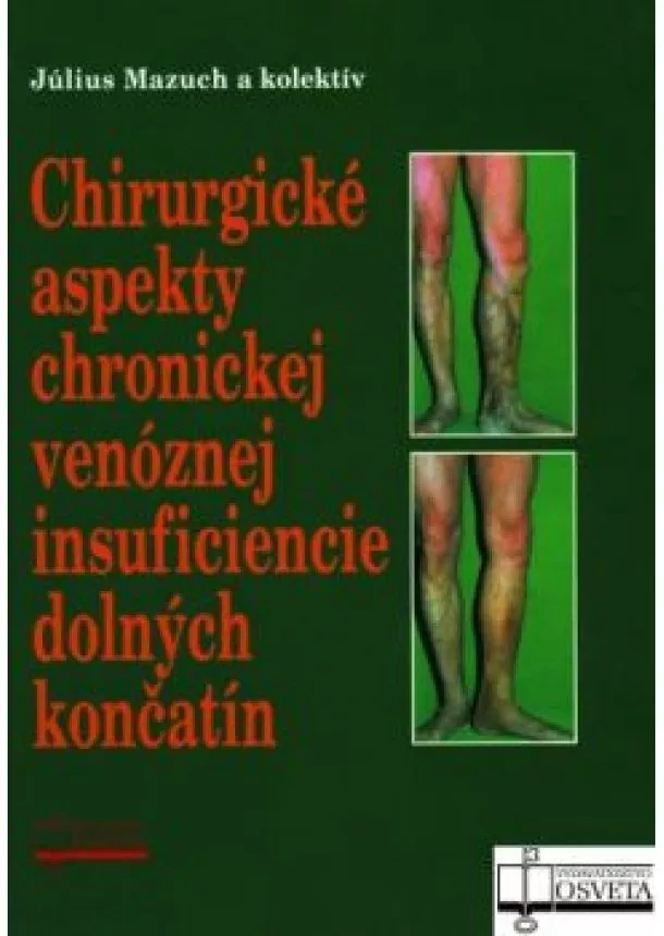 Július Mazúch a kol. - Chirurgické aspekty chronickej venóznej insuficiencie dolných končatín