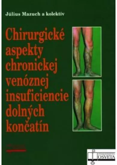 Chirurgické aspekty chronickej venóznej insuficiencie dolných končatín