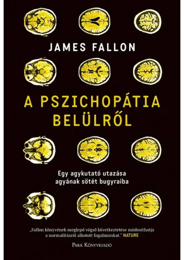 James Fallon - A pszichopátia belülről - Egy agykutató utazása agyának sötét bugyraiba