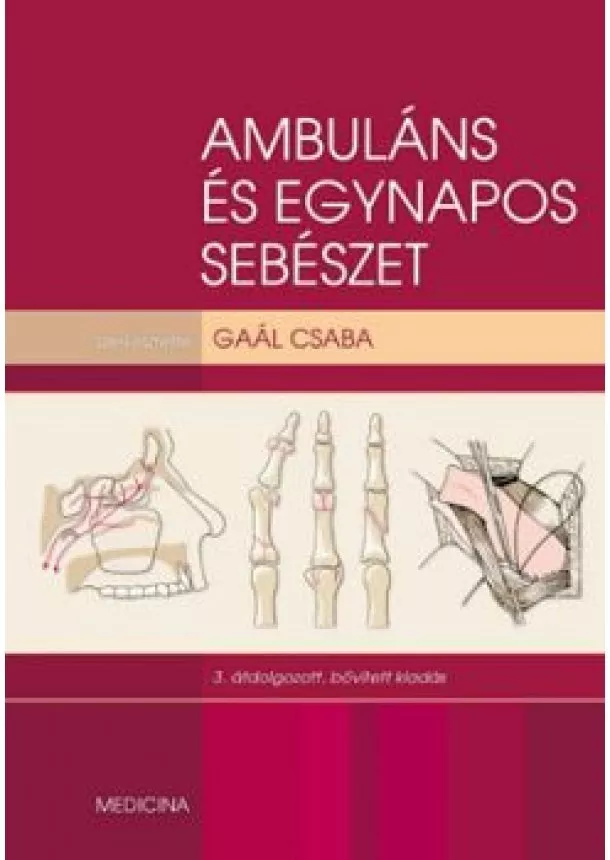 Gaál Csaba (szerkesztő) - Ambuláns és egynapos sebészet