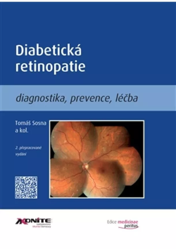 Tomáš Sosna - Diabetická retinopatie - Diagnostika, prevence, léčba