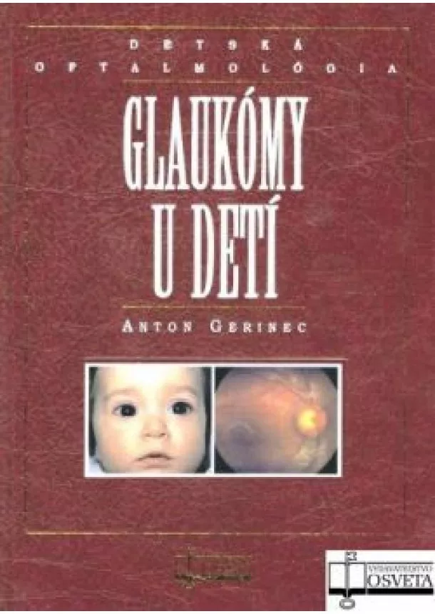 Anton Gerinec - Glaukómy u detí