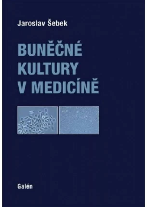 Jaroslav Šebek - Buněčné kultury v medicíně