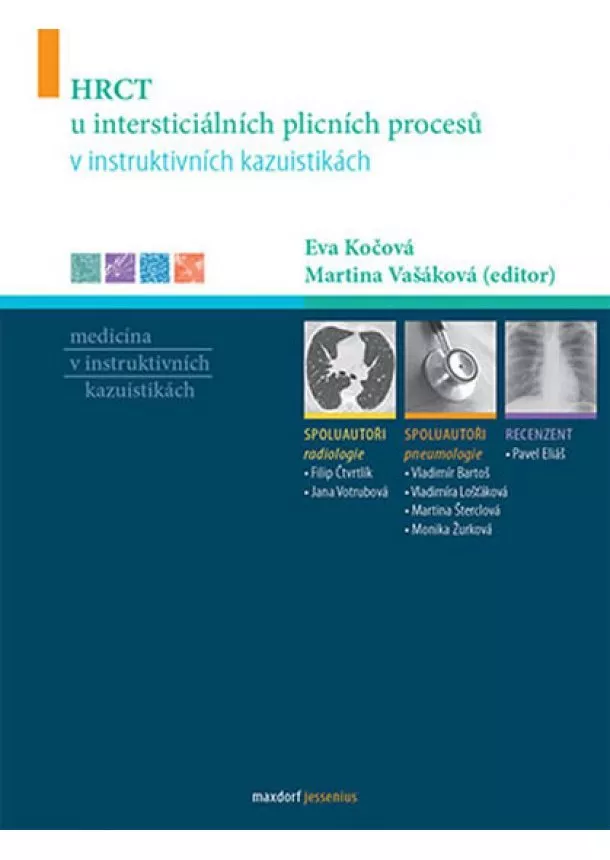 Eva Kočová, Martina Vašáková, Jana Votrubová - HRCT u intersticiálních plicních procesů v instruktivních kazuistikách