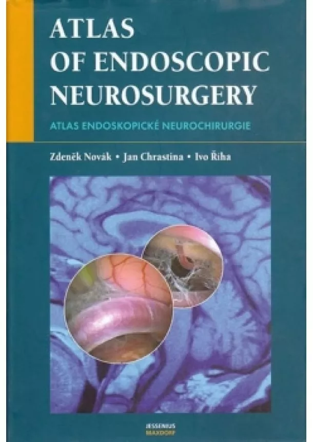 Zdeněk Novák, Jan Chrastina, Ivo Říha - Atlas endoskopické neurochirurgie