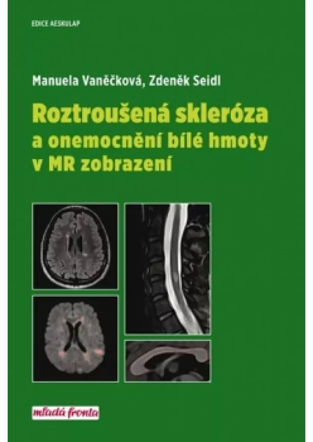 Manuela Vaněčková, Zdeněk Seidl - Roztroušená skleróza a onemocnění bílé hmoty v MR zobrazení