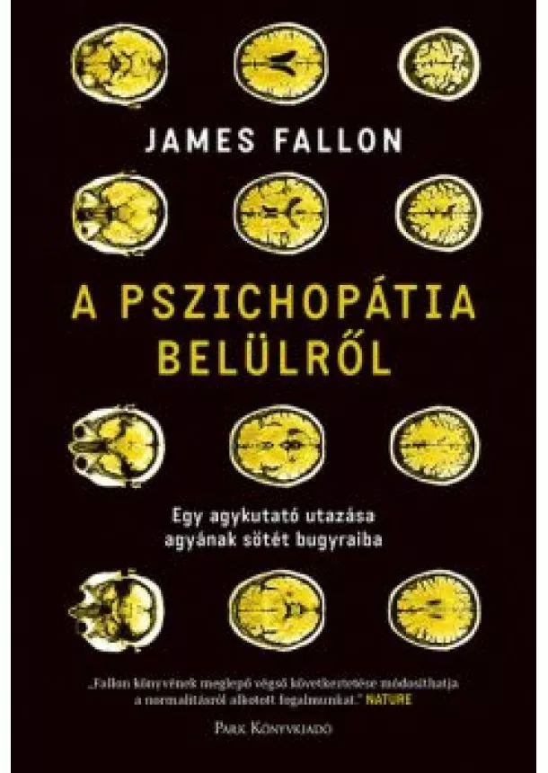 James Fallon - A pszichopátia belülről - Egy agykutató utazása agyának sötét bugyraiba