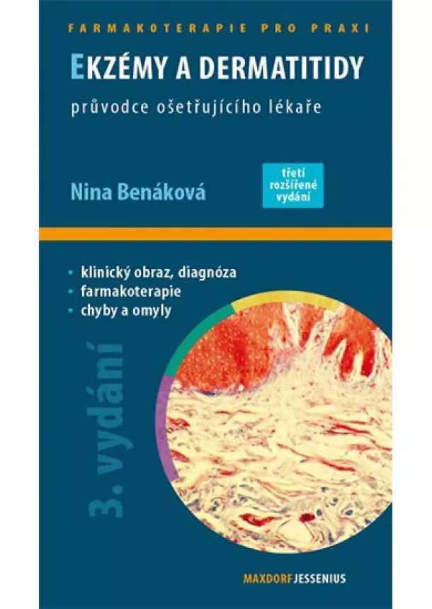 Nina Benáková - Ekzémy a dermatitidy - Průvodce ošetřujícího lékaře