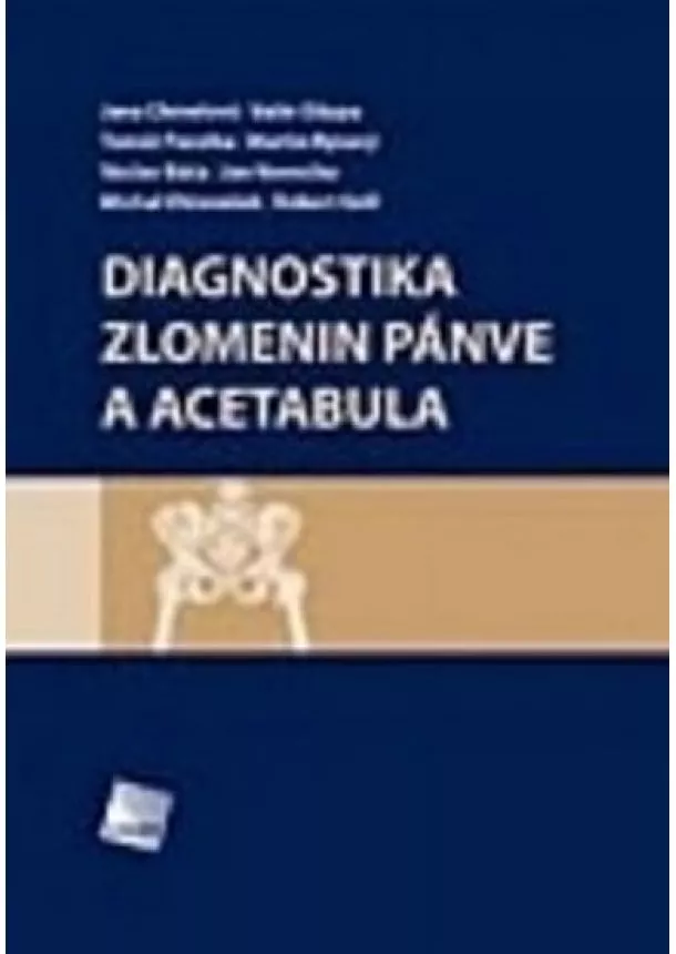 Jana Chmelová, Valér Džupa,Tomáš Pavelka, Martin Ryšavý, Václav Báča, Jan Vavrečka, Michal Otčenášek, Robert Grill - Diagnostika zlomenin pánve a acetabula