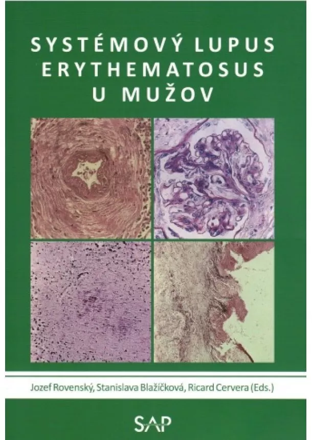 Jozef Rovenský, Stanislava Blažičková, Ricard Cervera - Systemovy lupus erythematosus u muzov