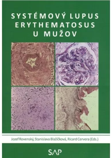 Systemovy lupus erythematosus u muzov