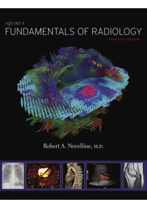 Robert A. Novelline - Squires Fundamentals of Radiology