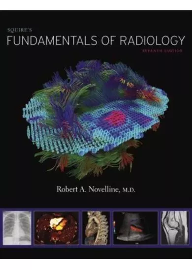 Squires Fundamentals of Radiology