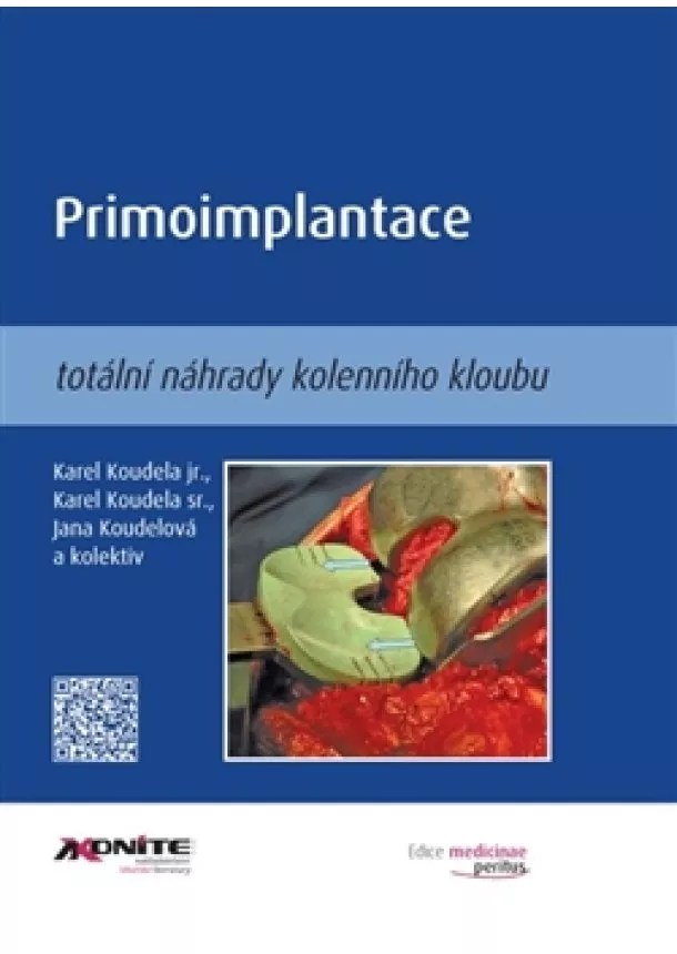 Karel Koudela jr., Karel Koudela st., Jana Koudelová - Primoimplantace totální náhrady kolenního kloubu