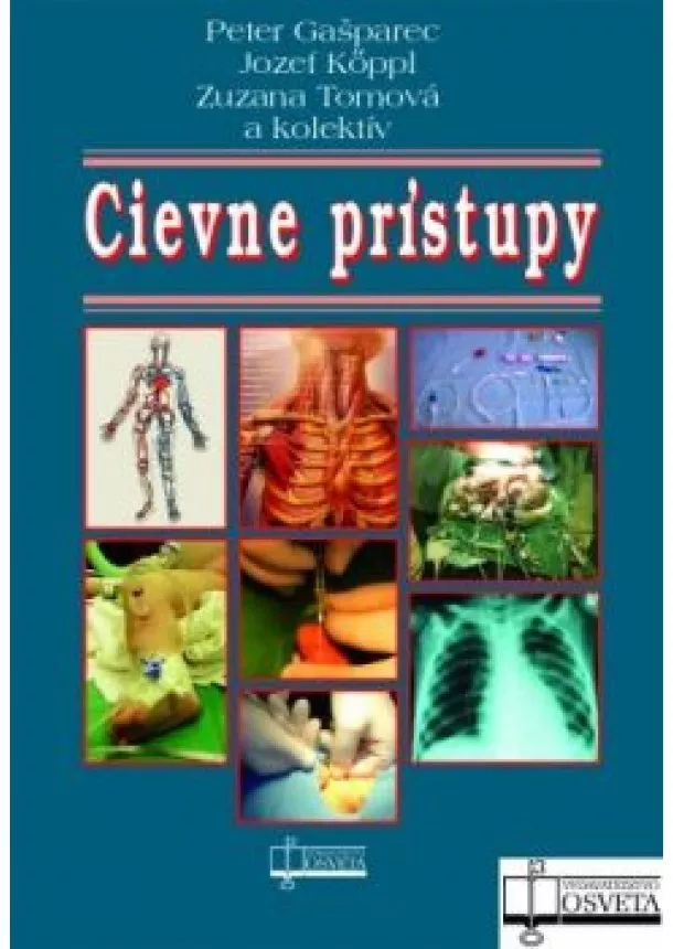 Peter Gašparec - Cievne prístupy