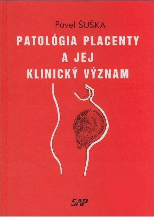 Pavel Šuška   - Patológia placenty a jej klinický význam