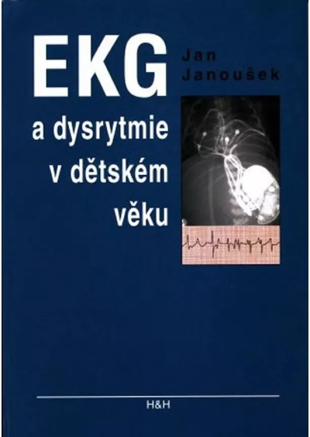 Jan Janoušek - EKG a dysrytmie v dětském věku (Praktický návod k diagnostice a léčbě)