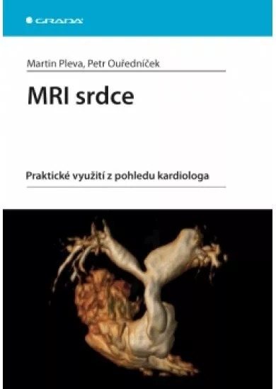 MRI srdce -  praktické využití z pohledu kardiologa