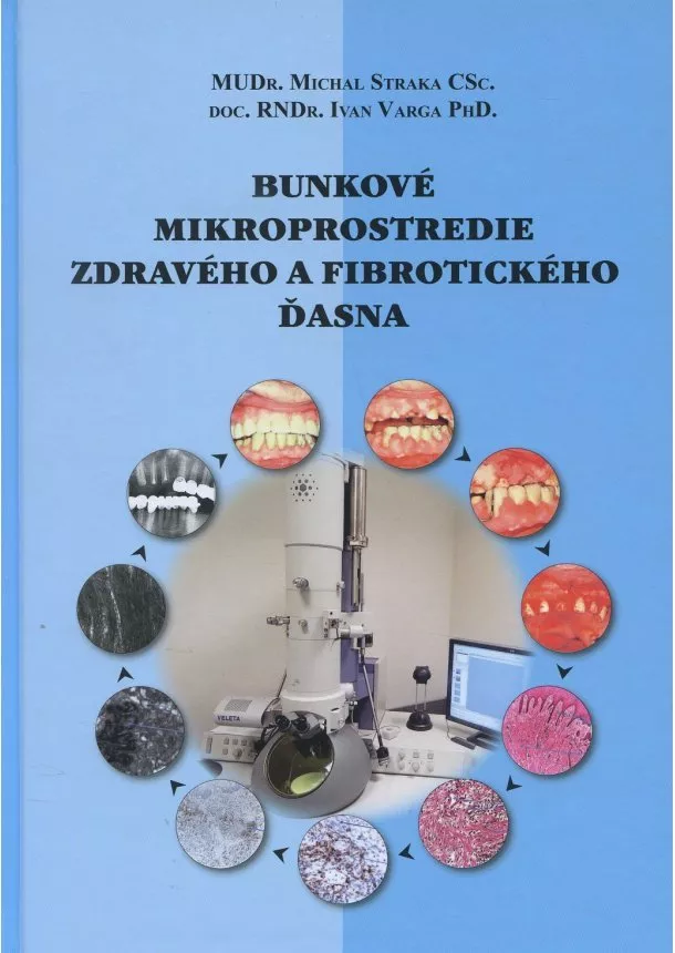 Michal Straka, Ivan Varga - Bunkové mikroprostredie zdravého a fibrotického ďasna