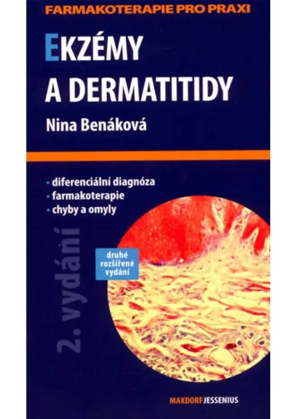 Nina Benáková - Ekzémy a dermatitidy - 2. vydání