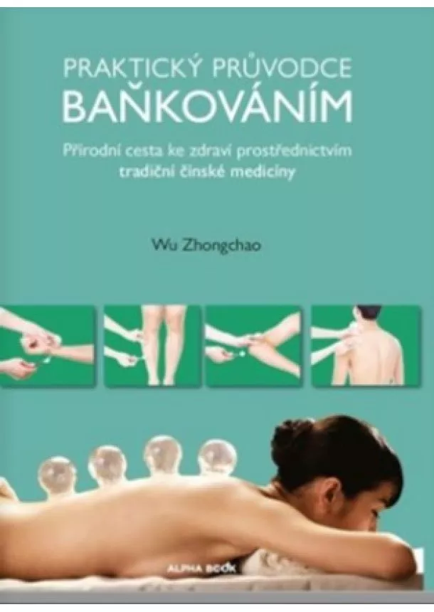 Wu Zhongchao  - Praktický průvodce baňkováním - Přírodní cesta ke zdraví prostřednictvím tradiční čínské medicíny