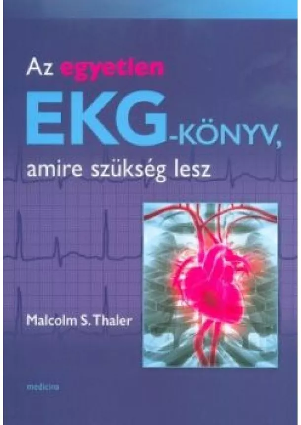 Malcolm S. Thaler - Az egyetlen EKG-könyv, amire szükség lesz