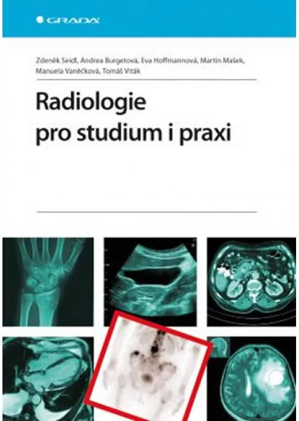 Zdeněk Seidl - Radiologie pro studium i praxi