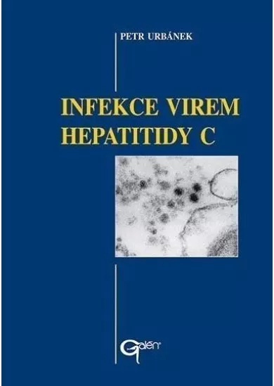 Infekce virem hepatitidy C