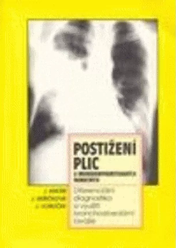 Jiří Mayer, Jana Skřičková, Jiří Vorlíček - Postižení plic u imunokompromitovaných nemocných - Diferenciální diagnostika a využití bronchoaveolární laváže