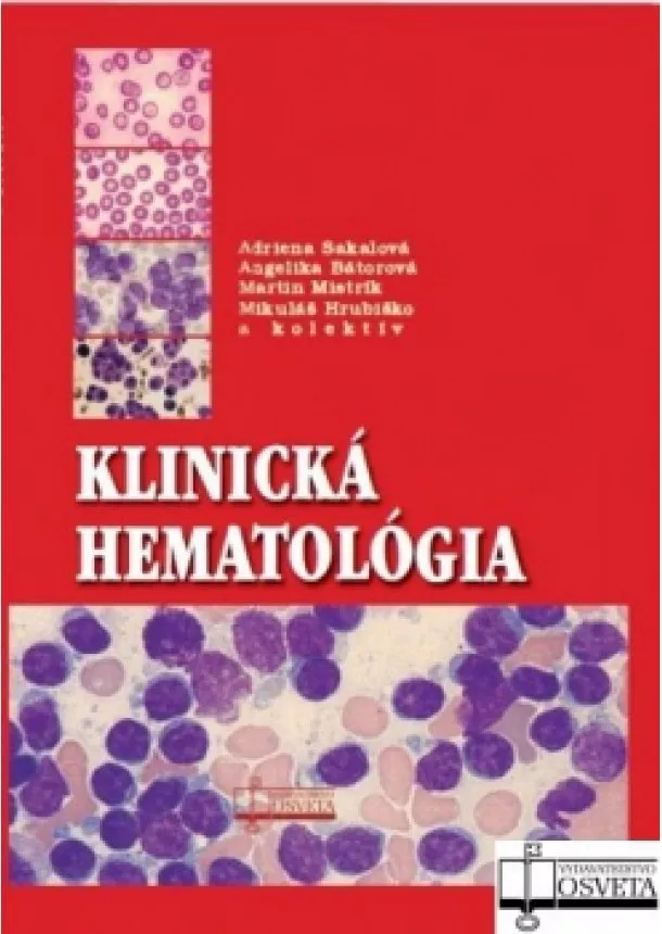 A. Sakalová, A. Bátorová, M. Mistrík, M. Hrubiško - Klinická hematológia