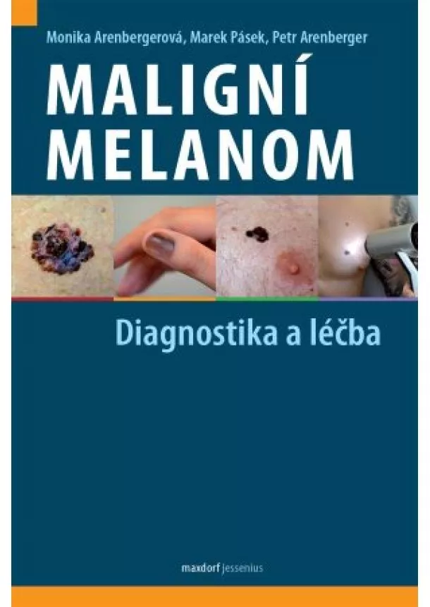 Monika Arenbergerová, Marek Pásek, Petr Arenberger - Maligní melanom - Diagnostika a léčba