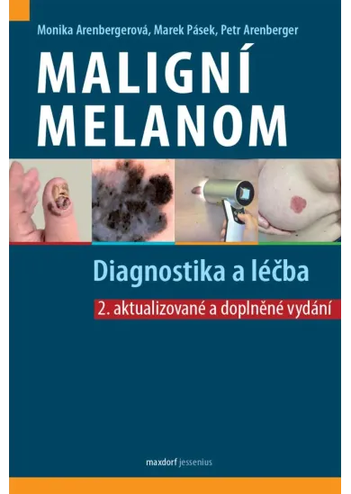 Maligní melanom (2.aktualizované a doplněné vydání) - Diagnostika a léčba