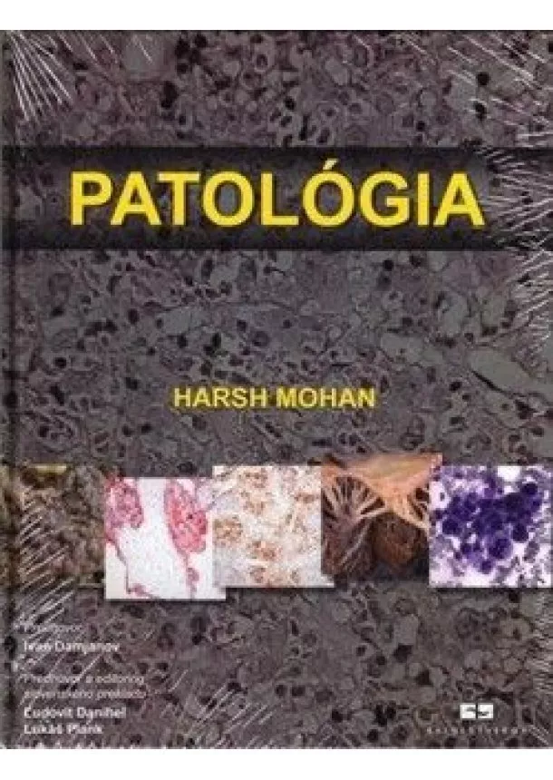 Mohan Hars - Patológia