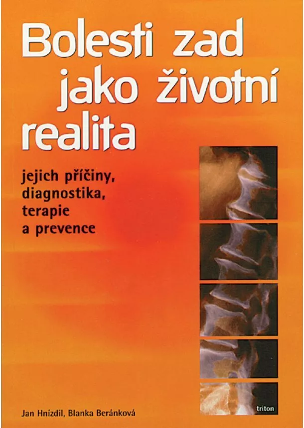 Jan Hnízdil - Bolesti zad jako životní realita