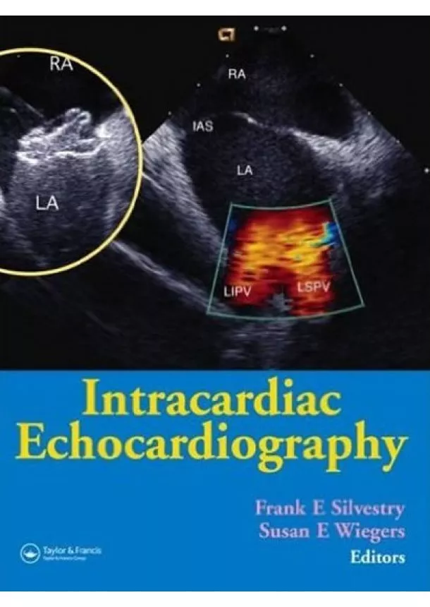 Frank Silvestry E. - Intracardiac Echocardiography