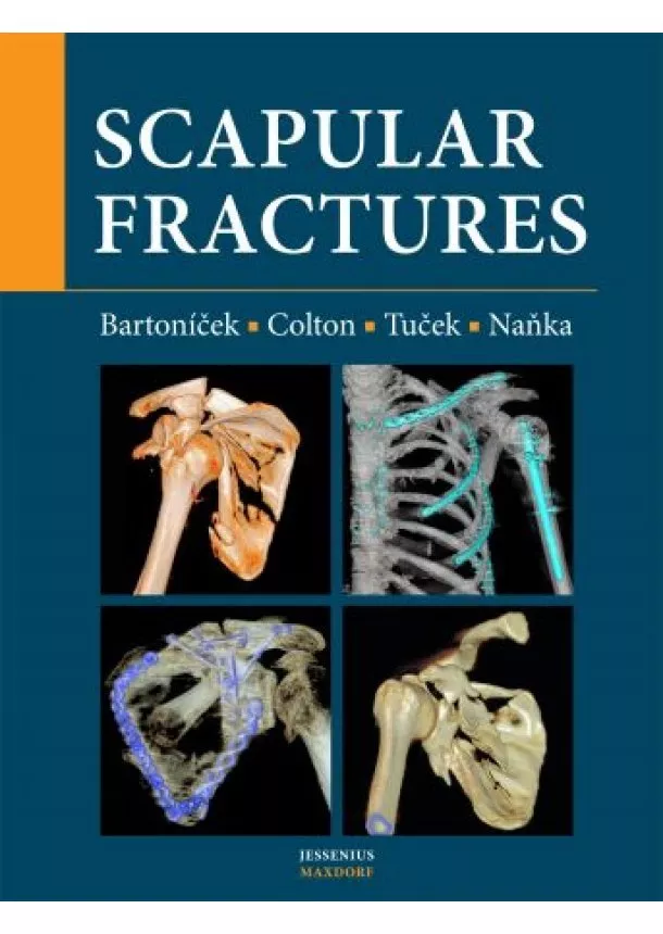 Jan Bartoníček, Christopher Colton, Michal Tuček - Scapular fractures