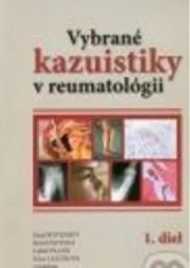 Vybrané kazuistiky v reumatológii (1+2 diel)