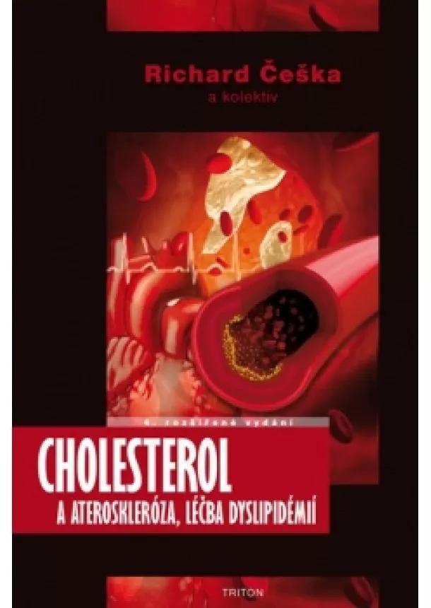 Richard Češka - Cholesterol a ateroskleróza, léčba dysli